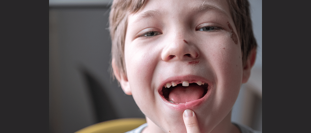 kid missing tooth