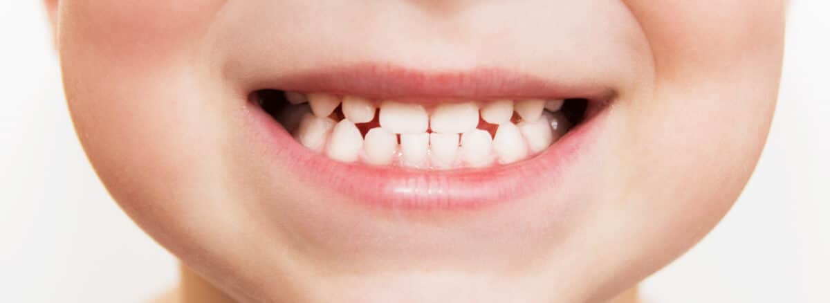 close up of a child smiling showing all of their baby teeth