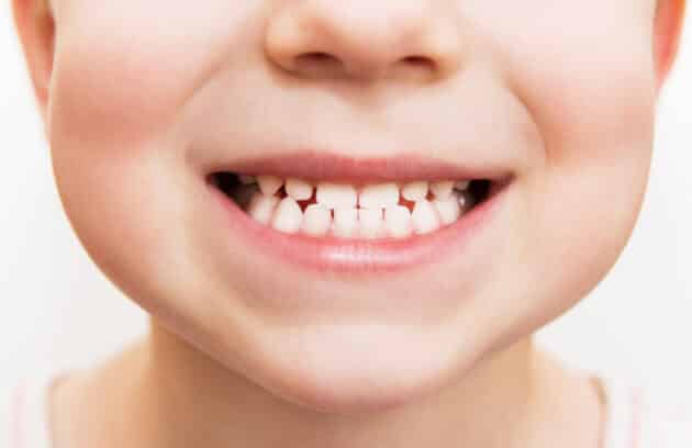 close up of a child smiling showing all of their baby teeth