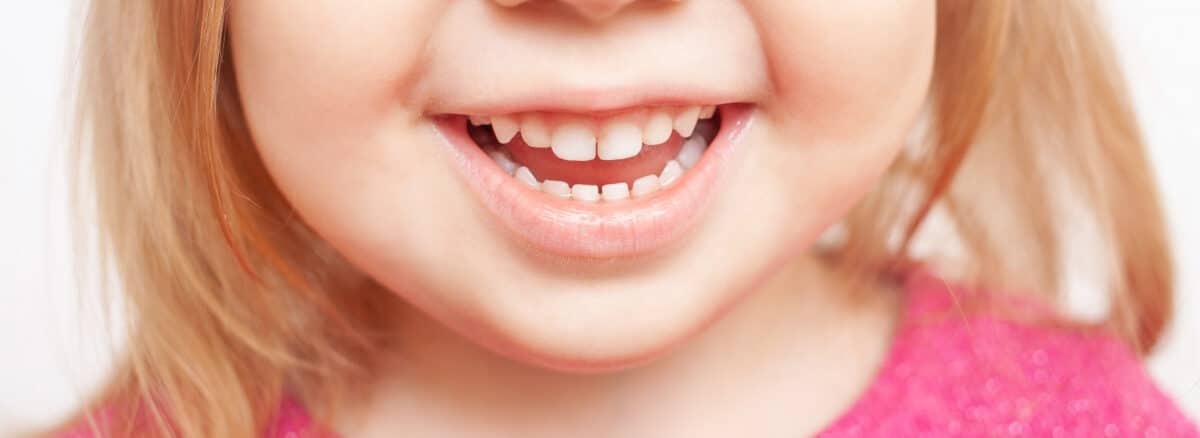 close up of a young girl smiling after a fluoride treatment at her pediatric dentist