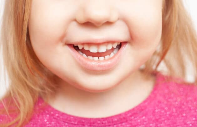 close up of a young girl smiling after a fluoride treatment at her pediatric dentist